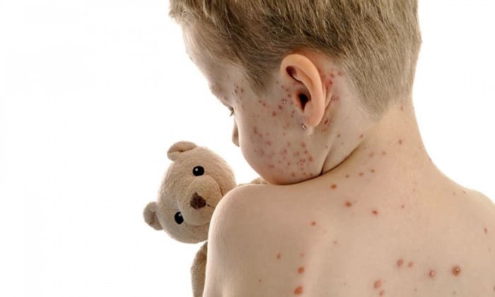 ТЕТРАДЕРМ – інструкція із застосування, ціна, відгуки і аналоги tetraderm nstrukc ya z zastosuvannya c na v dguki analogi 6 - ТЕТРАДЕРМ – інструкція із застосування, ціна, відгуки і аналоги