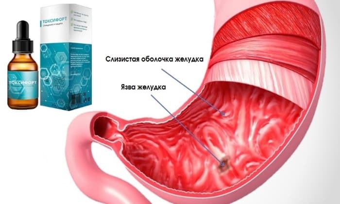 ТОКСИФОРТ від ГРИБКА: відгуки, ціна, склад і чи варто купувати toksifort v d gribka v dguki c na sklad chi varto kupuvati 15 - ТОКСИФОРТ від ГРИБКА: відгуки, ціна, склад і чи варто купувати