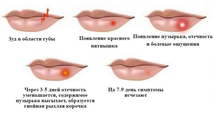 ТРИДЕРМ або АКРИДЕРМ: що краще і в чому різниця (відмінність складів, відгуки лікарів) triderm abo akriderm scho krasche v chomu r znicya v dm nn st sklad v v dguki l kar v 9 - ТРИДЕРМ або АКРИДЕРМ: що краще і в чому різниця (відмінність складів, відгуки лікарів)