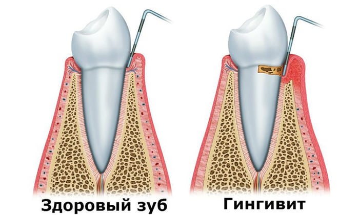 v taon lyuks nstrukc ya z zastosuvannya c na v dguki analogi 5 - ВІТАОН ЛЮКС – Інструкція із застосування, ціна, відгуки і аналоги