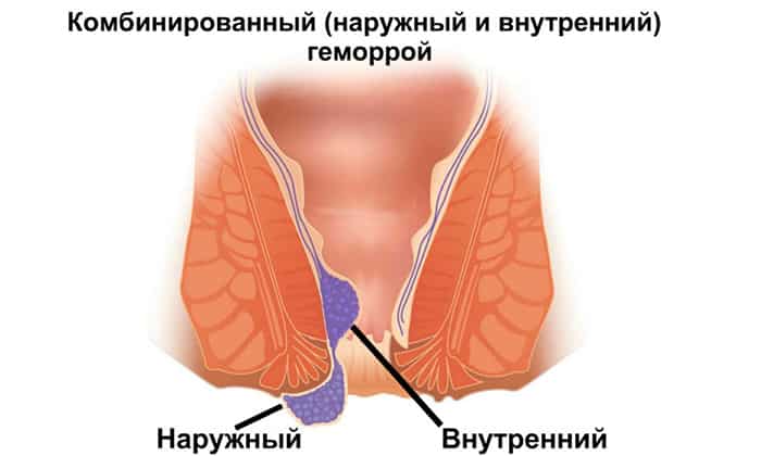 v taon lyuks nstrukc ya z zastosuvannya c na v dguki analogi 7 - ВІТАОН ЛЮКС – Інструкція із застосування, ціна, відгуки і аналоги