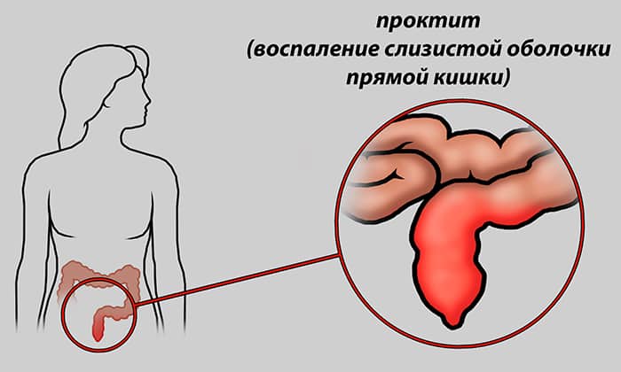 v taon lyuks nstrukc ya z zastosuvannya c na v dguki analogi 8 - ВІТАОН ЛЮКС – Інструкція із застосування, ціна, відгуки і аналоги