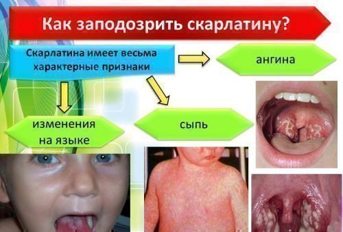 visip na mov b liy nal t chervoniy yazik alergiya prichini 6 - Висип на мові: білий наліт, червоний язик, алергия, причини