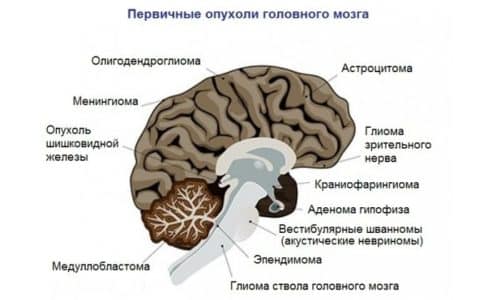 yak alkogol vpliva na golovniy mozok 4 - Як алкоголь впливає на головний мозок?