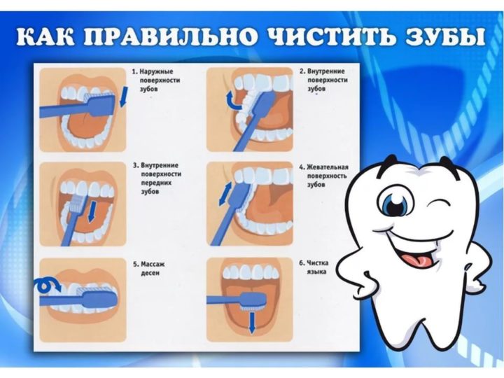 yak pravil no chistiti zubi d tyam z yakogo v ku pochinati yak navchiti malyuka robiti ce samost yno ta nsh rekomendac v deo 7 - Як правильно чистити зуби дітям, з якого віку починати, як навчити малюка робити це самостійно та інші рекомендації + відео