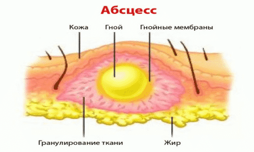 ЙОДДИЦЕРИН – інструкція із застосування, ціна, відгуки і аналоги yoddicerin nstrukc ya z zastosuvannya c na v dguki analogi 4 - ЙОДДИЦЕРИН – інструкція із застосування, ціна, відгуки і аналоги