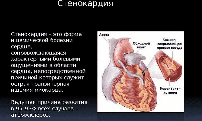 ЙОДДИЦЕРИН – інструкція із застосування, ціна, відгуки і аналоги yoddicerin nstrukc ya z zastosuvannya c na v dguki analogi 7 - ЙОДДИЦЕРИН – інструкція із застосування, ціна, відгуки і аналоги
