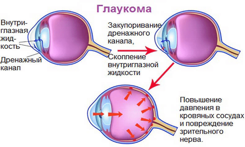 ЙОДДИЦЕРИН – інструкція із застосування, ціна, відгуки і аналоги yoddicerin nstrukc ya z zastosuvannya c na v dguki analogi 8 - ЙОДДИЦЕРИН – інструкція із застосування, ціна, відгуки і аналоги
