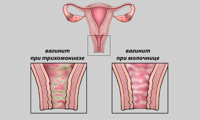ЙОДОВІДОН – інструкція із застосування, ціна, відгуки і аналоги yodov don nstrukc ya z zastosuvannya c na v dguki analogi 8 - ЙОДОВІДОН – інструкція із застосування, ціна, відгуки і аналоги