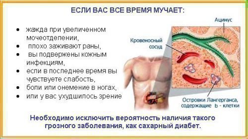 zapah z rota prichini l kuvannya u doroslih yak pozbutisya nazavzhdi 5 - Запах з рота: причини і лікування у дорослих, як позбутися назавжди