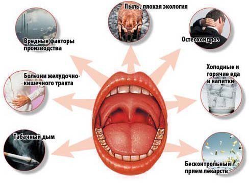 zapah z rota tonzil t yak pozbutisya prichigy poyavi l kuvannya 2 - Запах з рота, тонзиліт: як позбутися, причигы появи, лікування