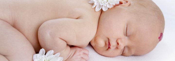Гемангіома у новонароджених дітей: причини і лікування цього захворювання