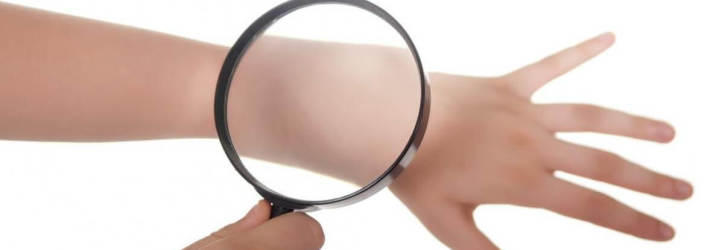 Поразка шкіри сухими вогнищами лущення на тілі – яке захворювання?