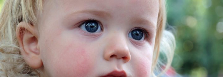 Всі види діатезу у дитини: опис симптомів, годування та лікування дітей. Якими народними засобами лікують діатез?